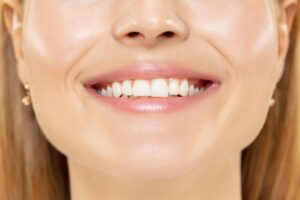teeth whitening