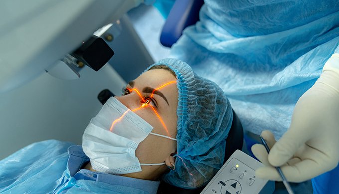 laser-eye-surgery