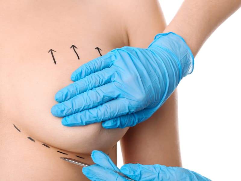 plastic-surgery